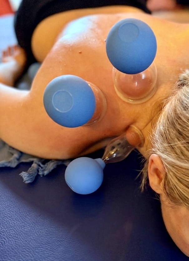 Therapeutic cupping with cups on the back