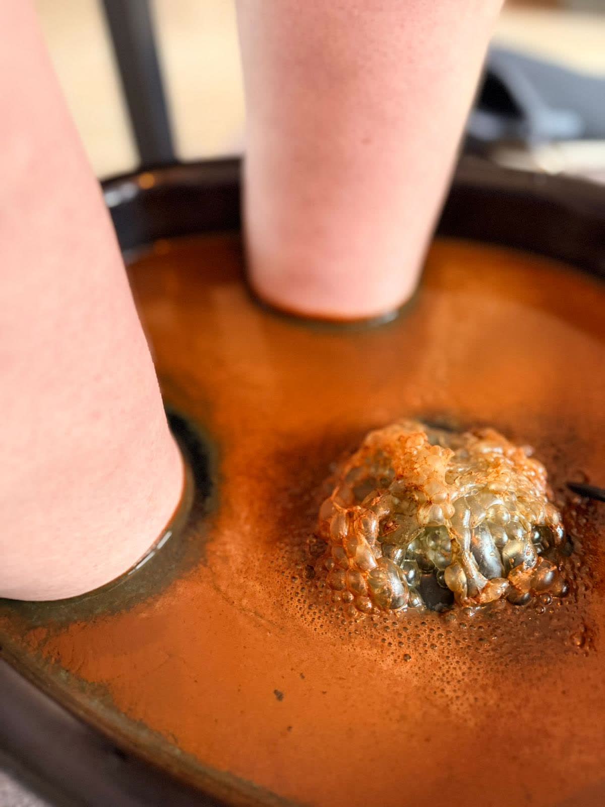 Foot balance treatment, detail